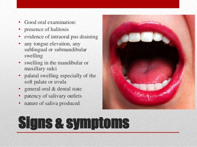 Charlize Theron Boob Mouth Infections Symptoms